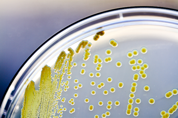 Morgenstund: Hvad taler bakterierne om? 