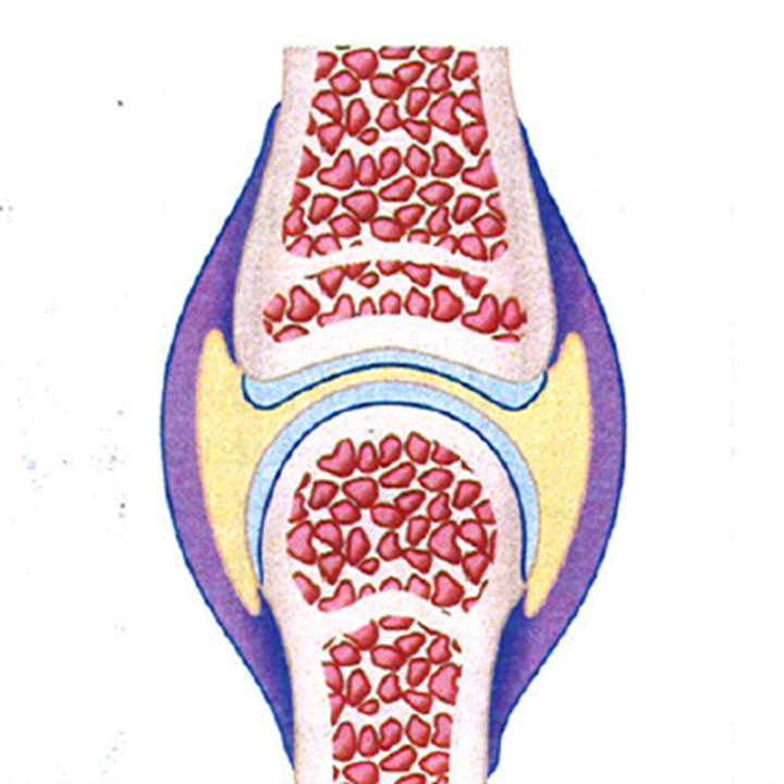 Leddegigt - årsager, symptomer og behandling